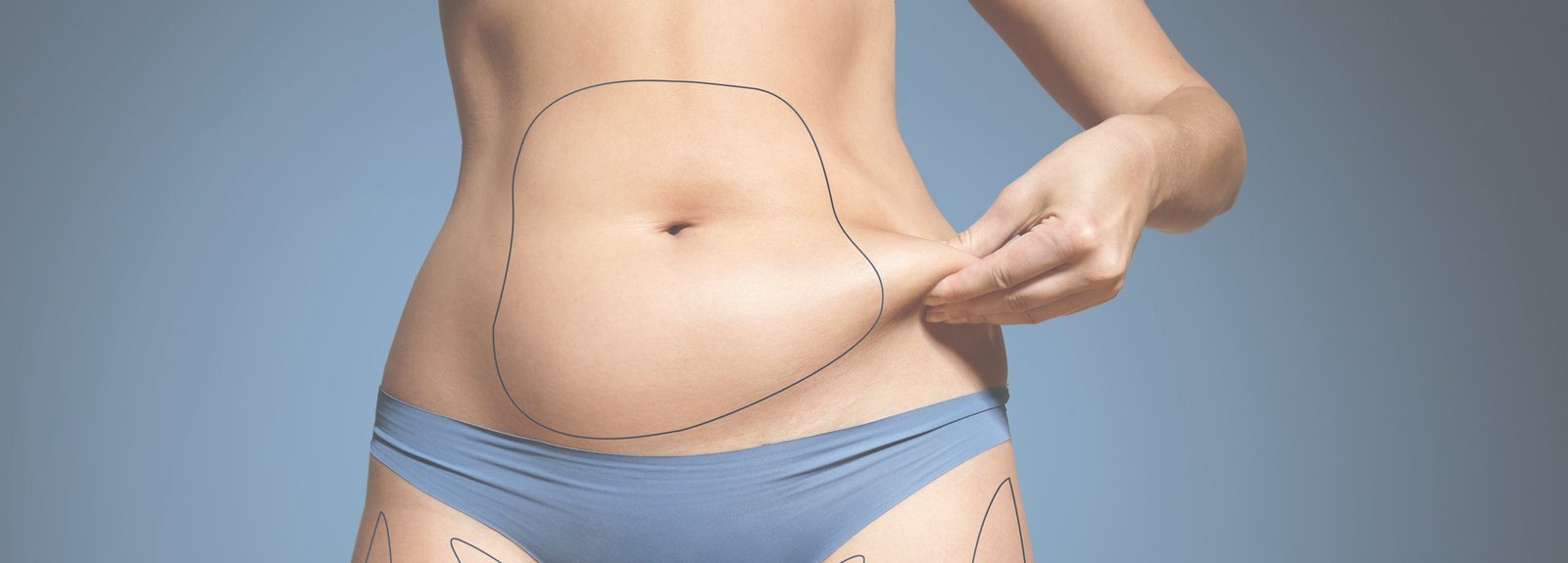 Coolsculpting Los Angeles